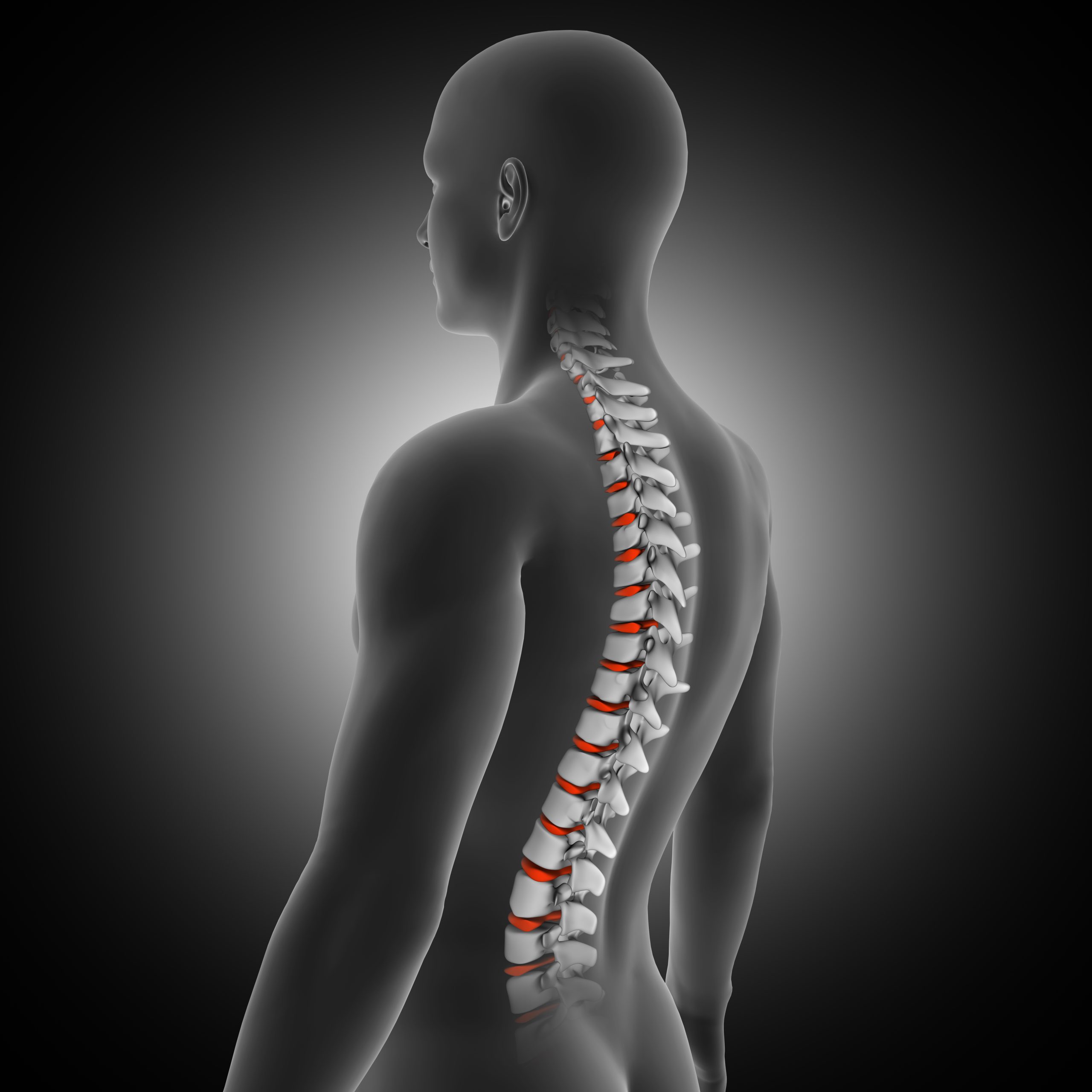Spinal Stenosis in Huber Heights | Pike Therapy Center
